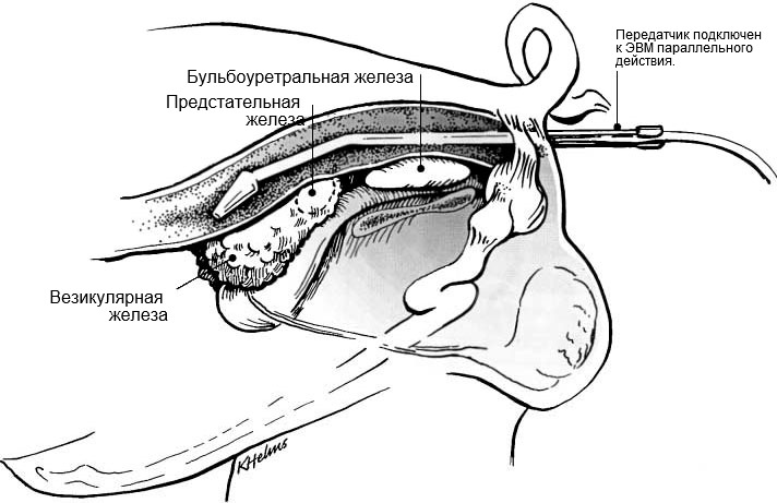 Рис. 1: Размещение держателя с передатчиком в прямой кишке для визуализации дополнительных половых желез хряка (Взято у Кларка и Альтхауса, 2002).Placement of transducer holder with the transducer per rectum for visualization of accessory sex glands of the boar (from Clark &amp; Althouse, 2002).
