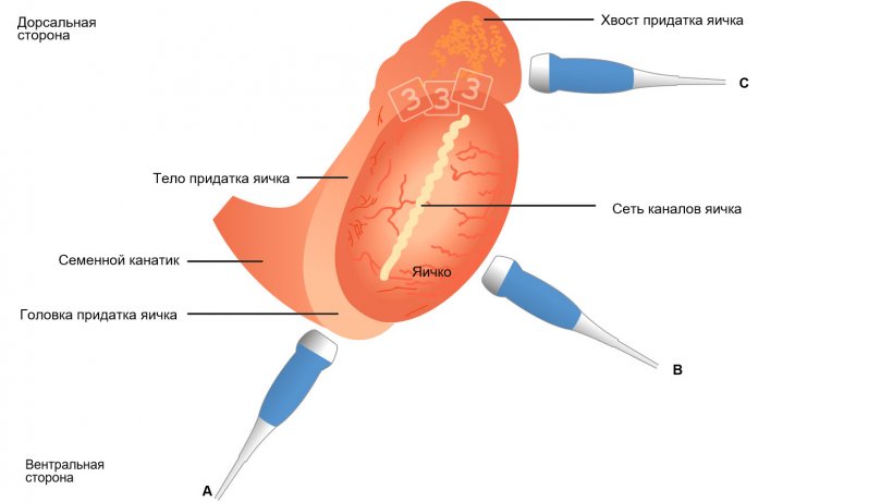 Рис. 4: Схематическая иллюстрация топографии яичка и его придатков у хряков с рекомендуемым размещением передатчика при обследовании головки придатка яичка (a), тела придатка яичка (b) и хвоста придатка яичка (c). Получать изображение головки и хвоста лучше всего в продольном направлении, а тела &ndash; в поперечном направлении (Взято у Кауффолда и др., 2011). Schematic illustration of the topography of the testis and epididymis in boars, with suggested transducer placement when assessing the epididymal caput (= head; a), corpus (b) and cauda (= tail; c). The caput and cauda are best imaged longitudinally and the corpus transversally (from Kauffold et al., 2011).
